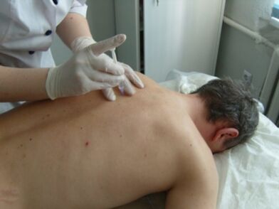 Torasik osteokondroz için eklem içi kondroprotektör enjeksiyonları